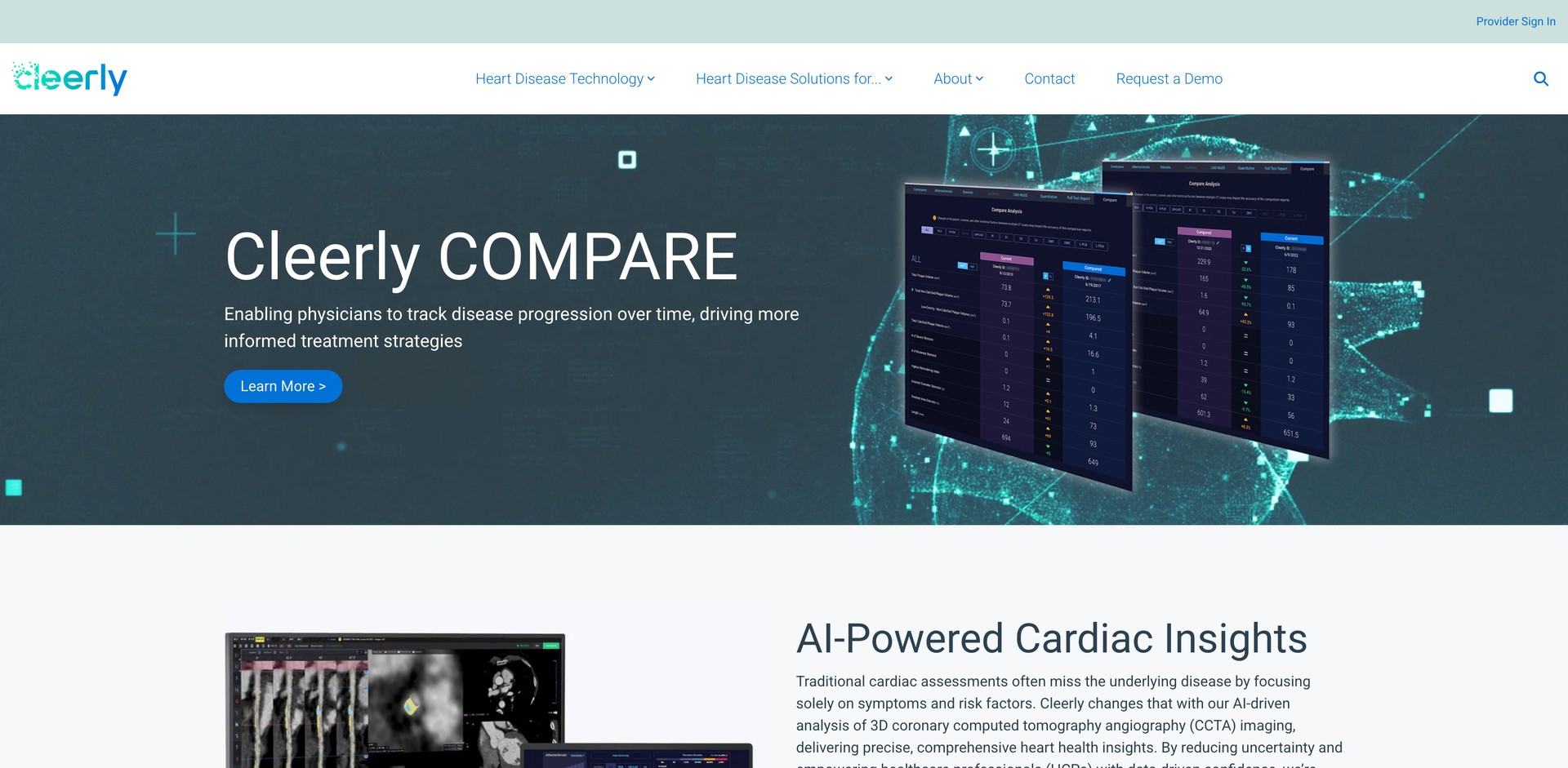 cleerlyhealth.com - CCTA image analysis for coronary plaque, ischemia, and stenosis d